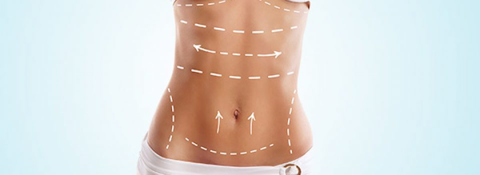 Body contouring ou Lifting corps