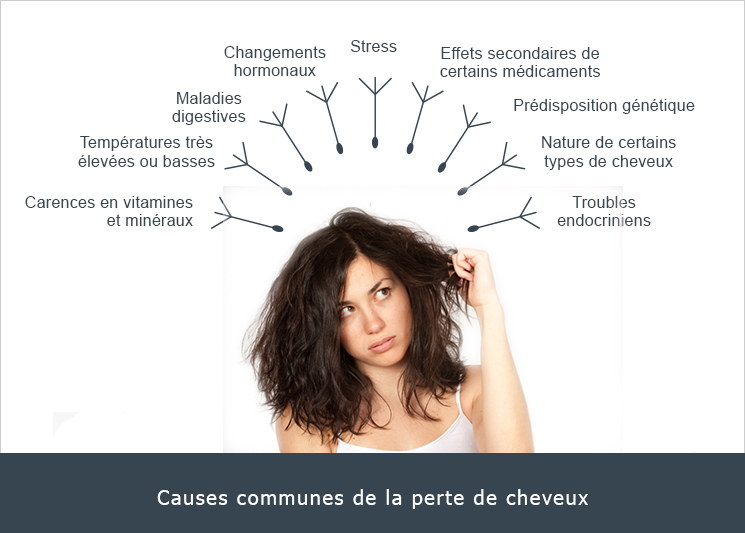 causes communes de la perte de cheveux